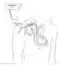 Fig. 01 - Implantable medical device having a scheme for managing storage of data