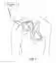 Fig. 02 - Implantable medical device having a scheme for managing storage of data