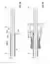 Fig. 05 - Electrode Implantation System