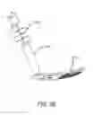 Fig. 13 - Electrode arrays for a visual prosthesis
