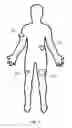 Fig. 02 - Electrical stimulation device for improving fluidity of motion