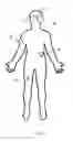 Fig. 03 - Electrical stimulation device for improving fluidity of motion