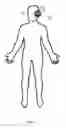 Fig. 06 - Electrical stimulation device for improving fluidity of motion