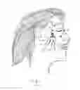 Fig. 02 - SURGICAL TOOLS AND METHODS FOR DELIVERING A NEUROSTIMULATOR INTO THE PTERYGOPALATINE FOSSA