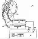 Fig. 01 - Method and system for controlling neural activity in the brain