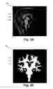 Fig. 06 - Load-preserving method for defining anisotropy in volume-conductor models