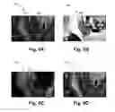 Fig. 07 - Load-preserving method for defining anisotropy in volume-conductor models