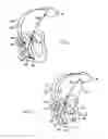 Fig. 02 - Active implantable medical device for detecting and quantifying fusion
