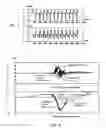 Fig. 03 - Active implantable medical device for detecting and quantifying fusion