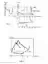 Fig. 04 - Active implantable medical device for detecting and quantifying fusion