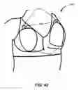 Fig. 43 - Apparatus and method for electromagnetic treatment of neurological injury or condition caused by a stroke