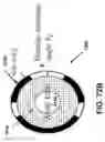 Fig. 65 - Advanced rotating-shield brachytherapy and planning of the same