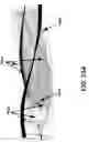 Fig. 66 - Advanced rotating-shield brachytherapy and planning of the same