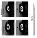 Fig. 72 - Advanced rotating-shield brachytherapy and planning of the same