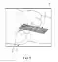 Fig. 04 - System for performing a therapeutic procedure