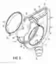 Fig. 06 - BAG FILTER ASSEMBLY