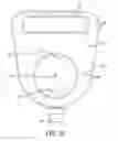 Fig. 07 - BAG FILTER ASSEMBLY