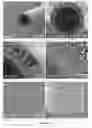 Fig. 09 - Hemodialyzer for blood purification
