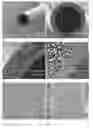 Fig. 10 - Hemodialyzer for blood purification