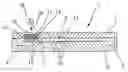 Fig. 01 - Apparatus for the separation of plasma