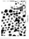 Fig. 19 - Method to control void formation in nanomaterials using core/alloy nanoparticles with stainless interfaces