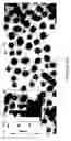 Fig. 22 - Method to control void formation in nanomaterials using core/alloy nanoparticles with stainless interfaces