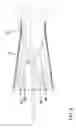 Fig. 05 - Debris collecting rotary tool attachment
