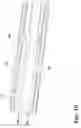 Fig. 11 - Bit holder assembly