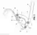 Fig. 02 - Soft Top Assist Tool