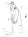 Fig. 04 - Soft Top Assist Tool
