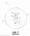 Fig. 08 - Hydro-formed film with three-dimensional micro-apertures