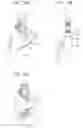 Fig. 12 - Apparatus for taking out molded product