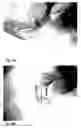 Fig. 12 - Formed thermoplastic article having smooth edges