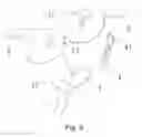 Fig. 05 - Foldable joint and stroller