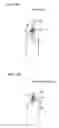 Fig. 10 - Beverage filling method and apparatus
