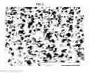 Fig. 06 - Porous ceramic composite particle and method for preparing the same