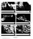 Fig. 10 - Ceramic composite and method to prepare the composite