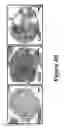 Fig. 06 - Bisaminoquinoline compounds, pharmaceutical compositions prepared therefrom and their use