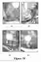 Fig. 16 - Bisaminoquinoline compounds, pharmaceutical compositions prepared therefrom and their use
