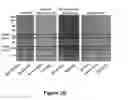 Fig. 05 - ANTIBODY PURIFICATION VIA AFFINITY CHROMATOGRAPHY