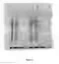 Fig. 04 - Precipitable peptides