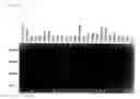 Fig. 04 - Chimeric inhibitor molecules of complement activation