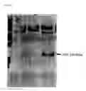 Fig. 10 - Chimeric inhibitor molecules of complement activation