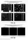 Fig. 04 - Method of treating retinopathy with an anti-LRP5 antibody