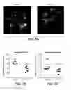 Fig. 10 - Method of treating retinopathy with an anti-LRP5 antibody