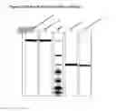 Fig. 02 - Fully human antibodies that bind to vascular endothelial growth factor receptor 2 (VEGFR2)
