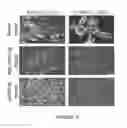 Fig. 06 - Chimeric antigen receptors recognizing cancer-specific TN glycopeptide variants