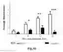 Fig. 44 - Methods for treating conditions associated with MASP-2 dependent complement activation