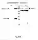 Fig. 32 - Methods for Treating Conditions Associated with MASP-2 Dependent Complement Activation