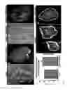 Fig. 03 - Technology for sustaining pluripotency and improved growth of stem cells in culture